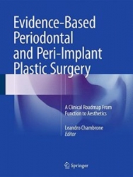 Evidence-Based Periodontal and Peri-Implant Plastic Surgery: A Clinical Roadmap from Function to Aesthetics (pdf)